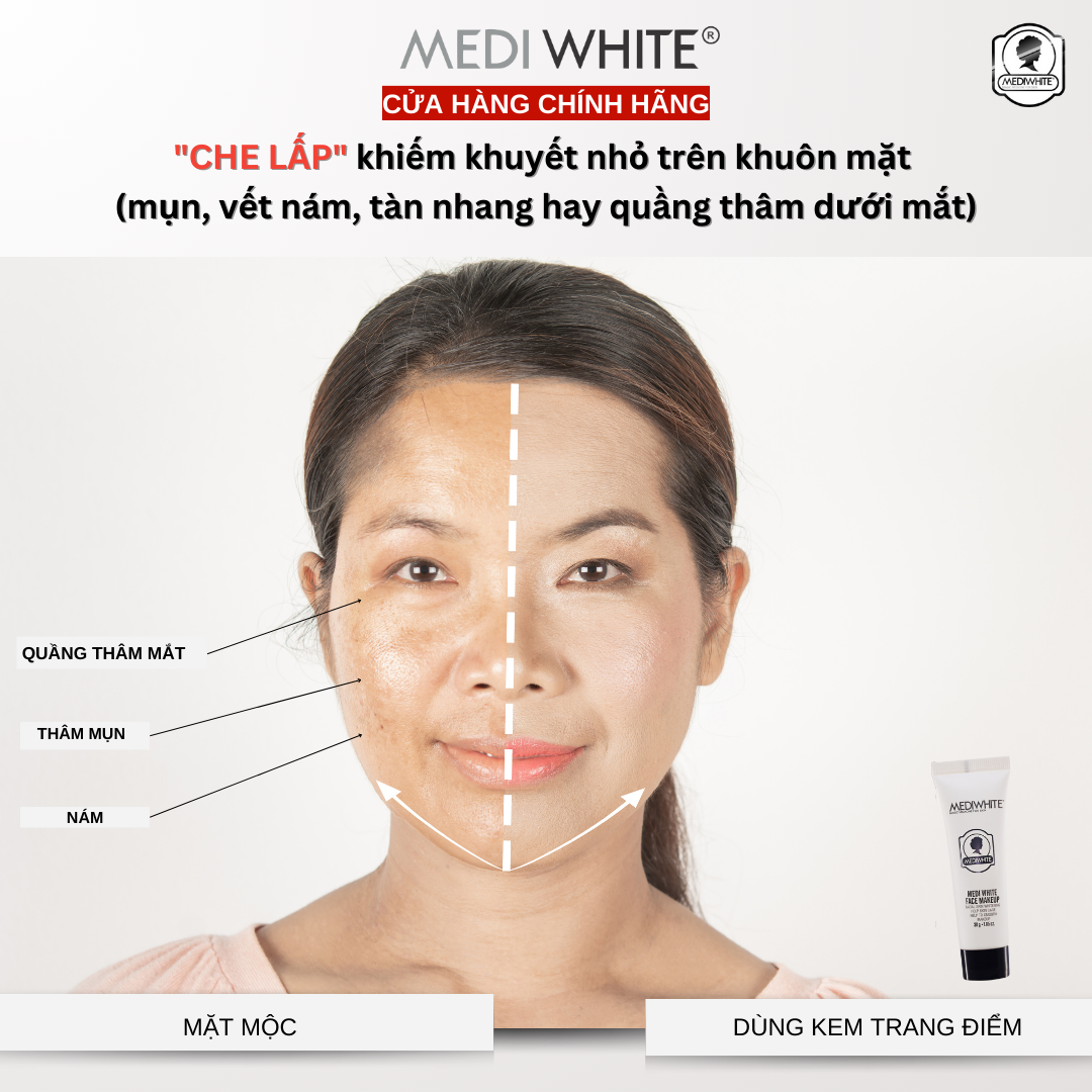 Kem Trang Điểm Mặt Medi White Face Make Up Kem Lười Che Khuyết Điểm Chống Nắng Kem Lót Nâng Tone Da 30g